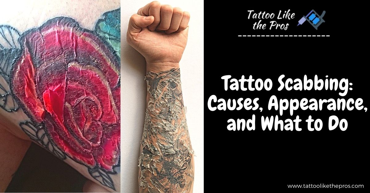 Tattoo Scabbing: Causes, Appearance, and What to Do