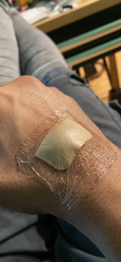 EalionMed Transparent Dressing customer review