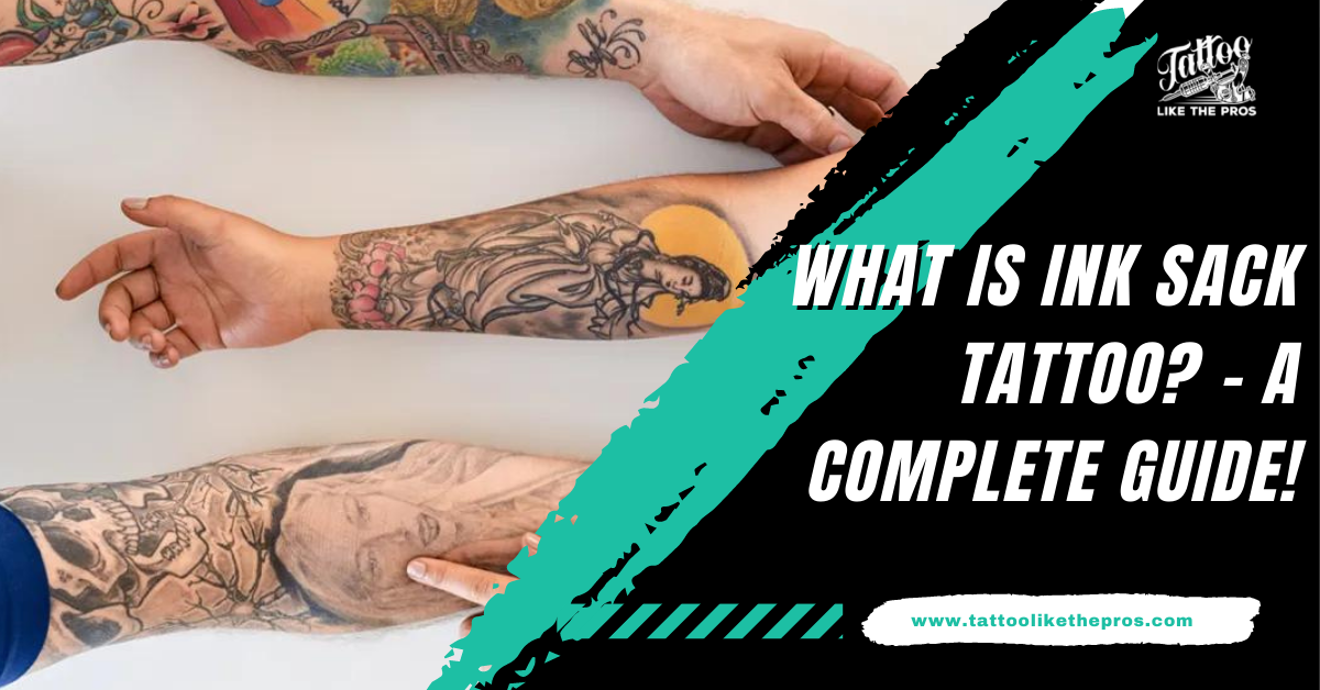 How Does Tattoo Removal Work A Beautiful You Medical Spa Aesthetic  Medical Spa