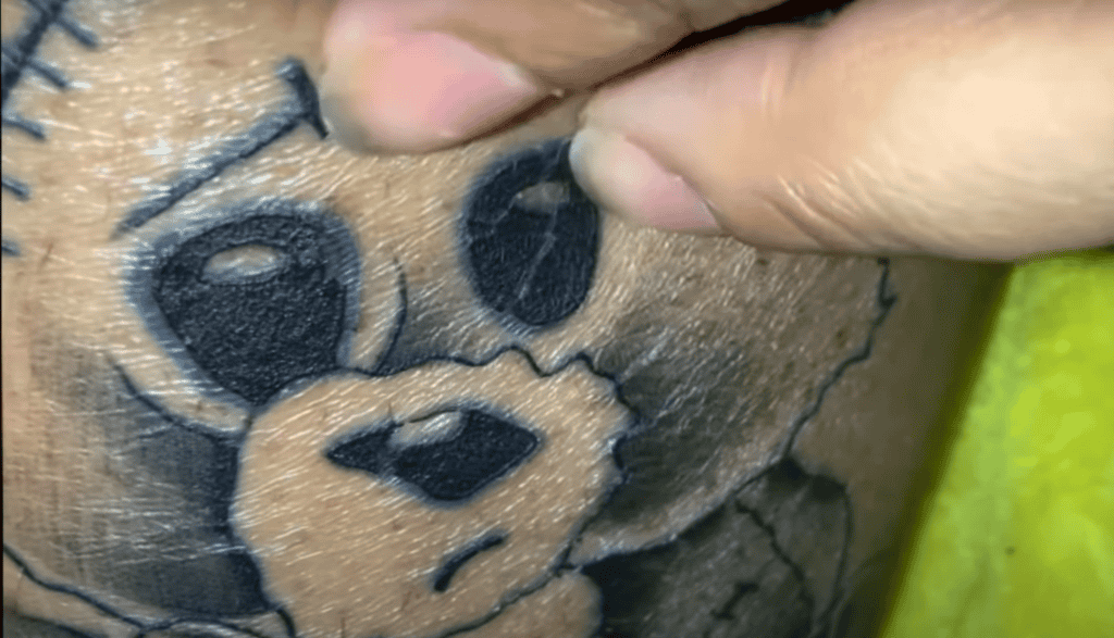 How Long Does a Wrinkled Tattoo Last?
